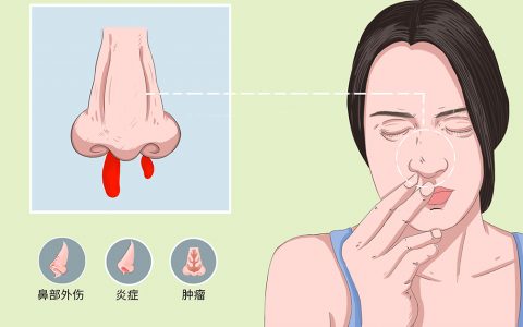 血小板减少鼻子流血该怎么处理
