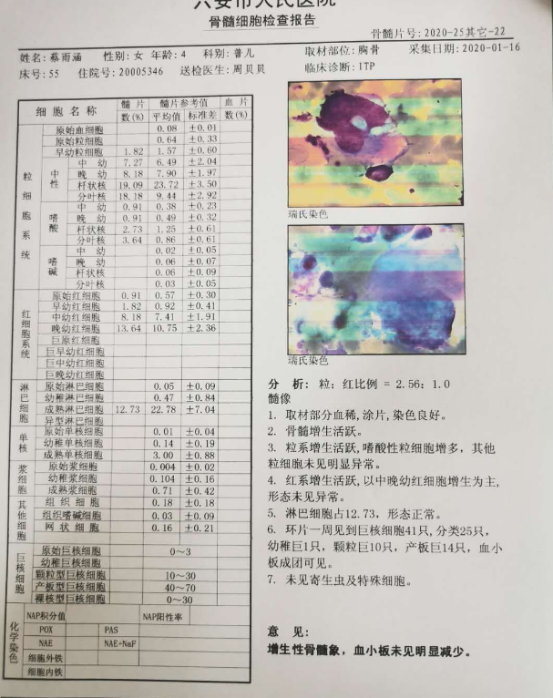 ITP骨穿报告