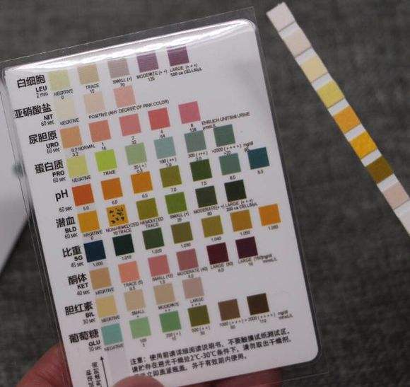 家庭自测尿蛋白试纸