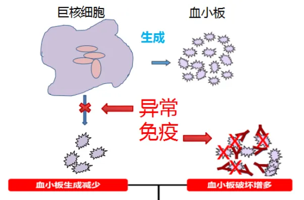 血小板减少原因